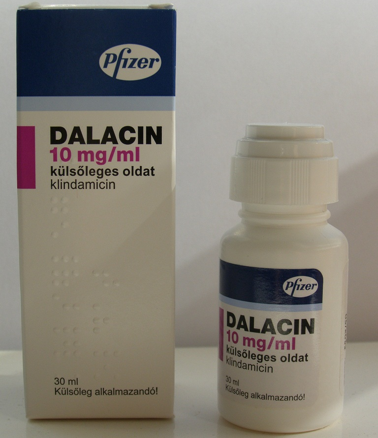 fallback image